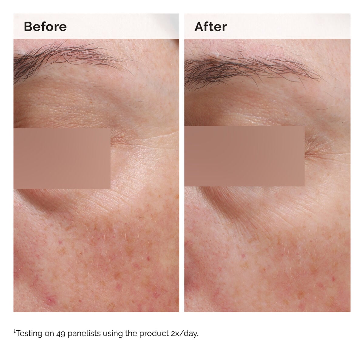 niacinamide-5-face-and-body-emulsion-n4 2024-08-23-ORD-Nia-5pct-Face-Body-B-A-Elasticity-Global-02-1x1.jpg