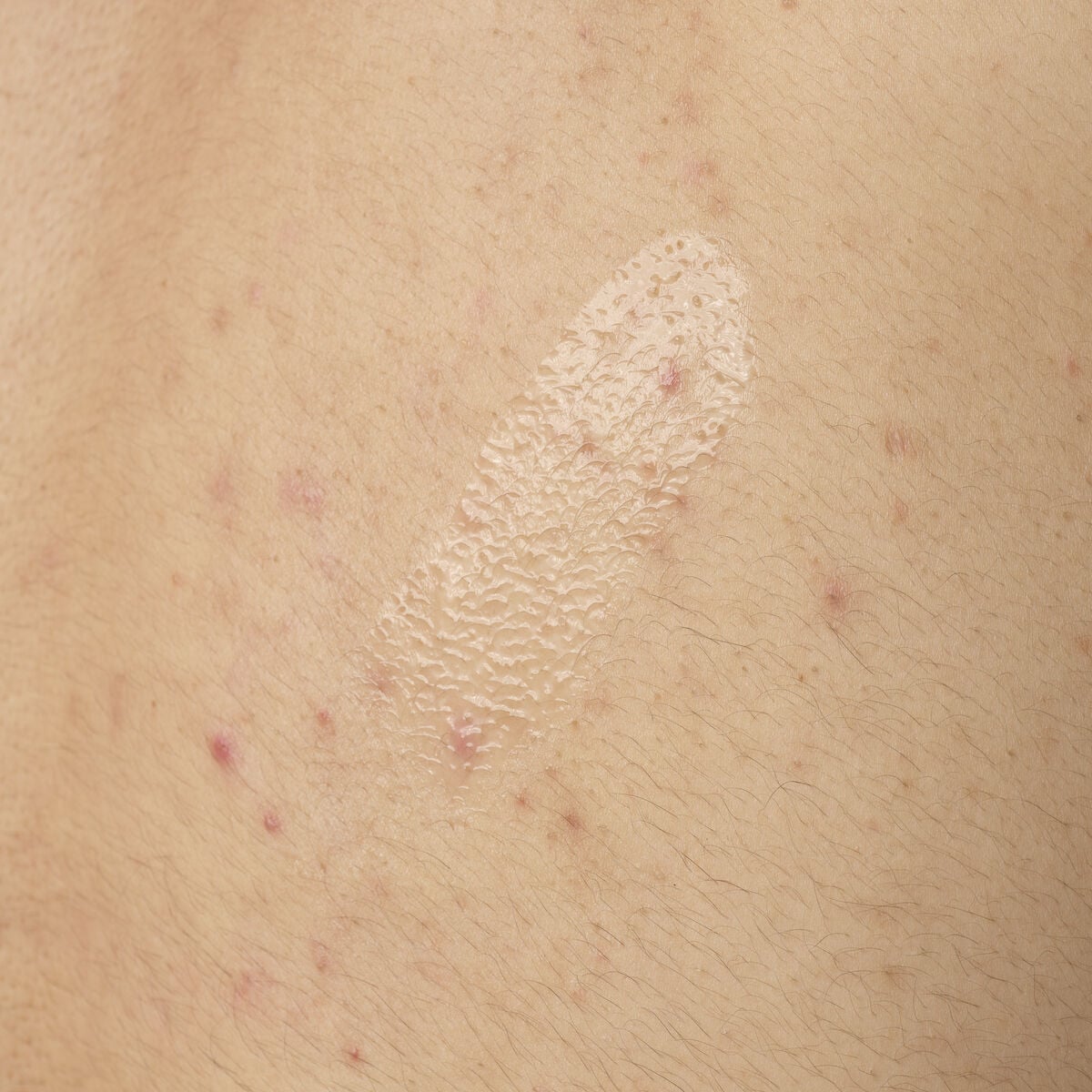 salicylic-acid-0-5-body-serum-m4 ORD-salicylic-acid-05-body-240ml-application.jpg