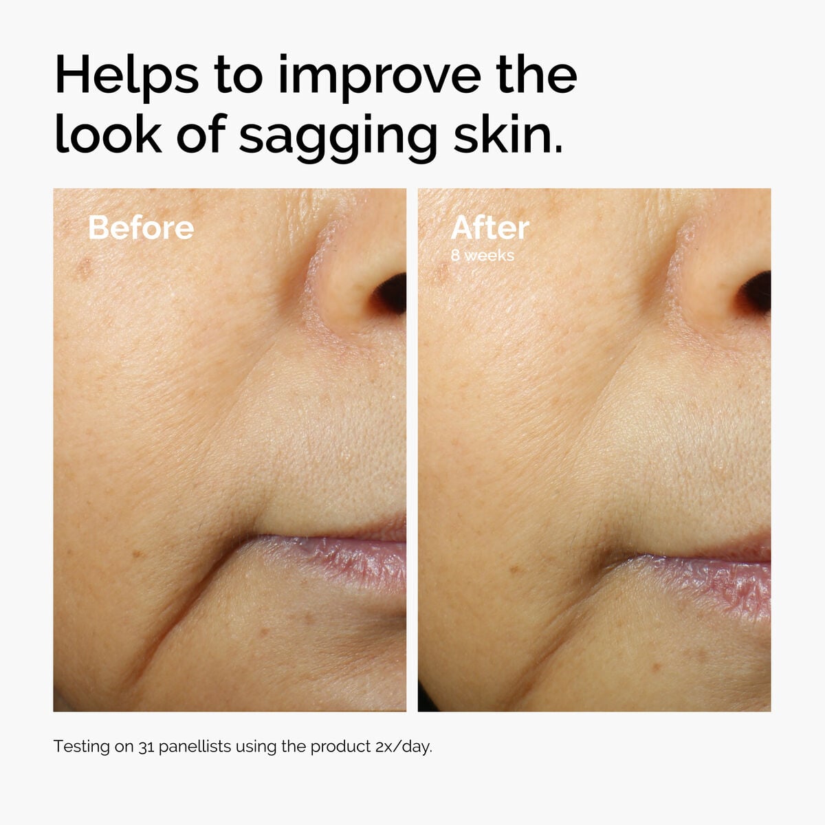 caffeine-3-escin-1-face-serum-b7 ord-caffeine-3pct-escin-1pct-face-serum-before-after-sagging.jpg