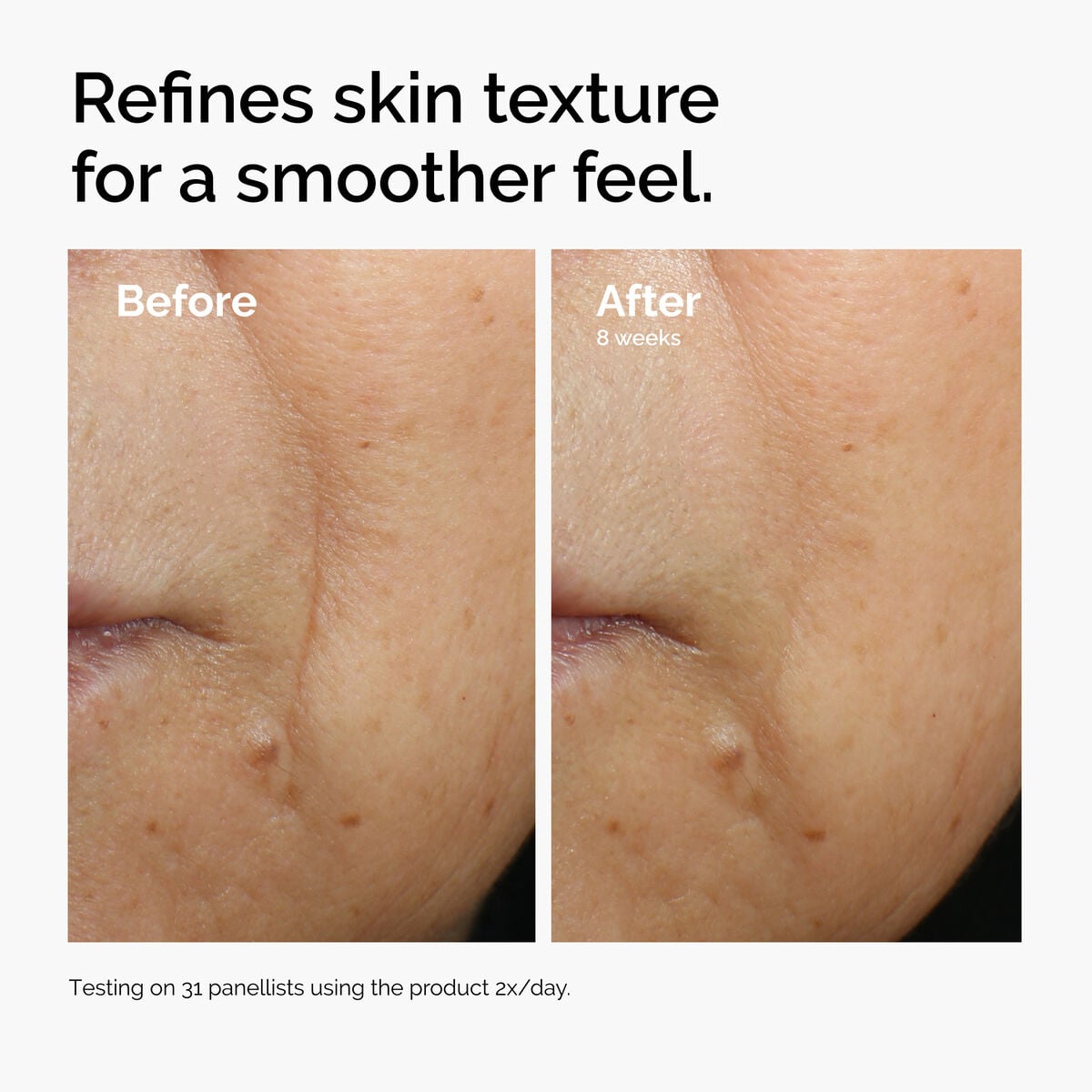 caffeine-3-escin-1-face-serum-b7 ord-caffeine-3pct-escin-1pct-face-serum-before-after-texture.jpg