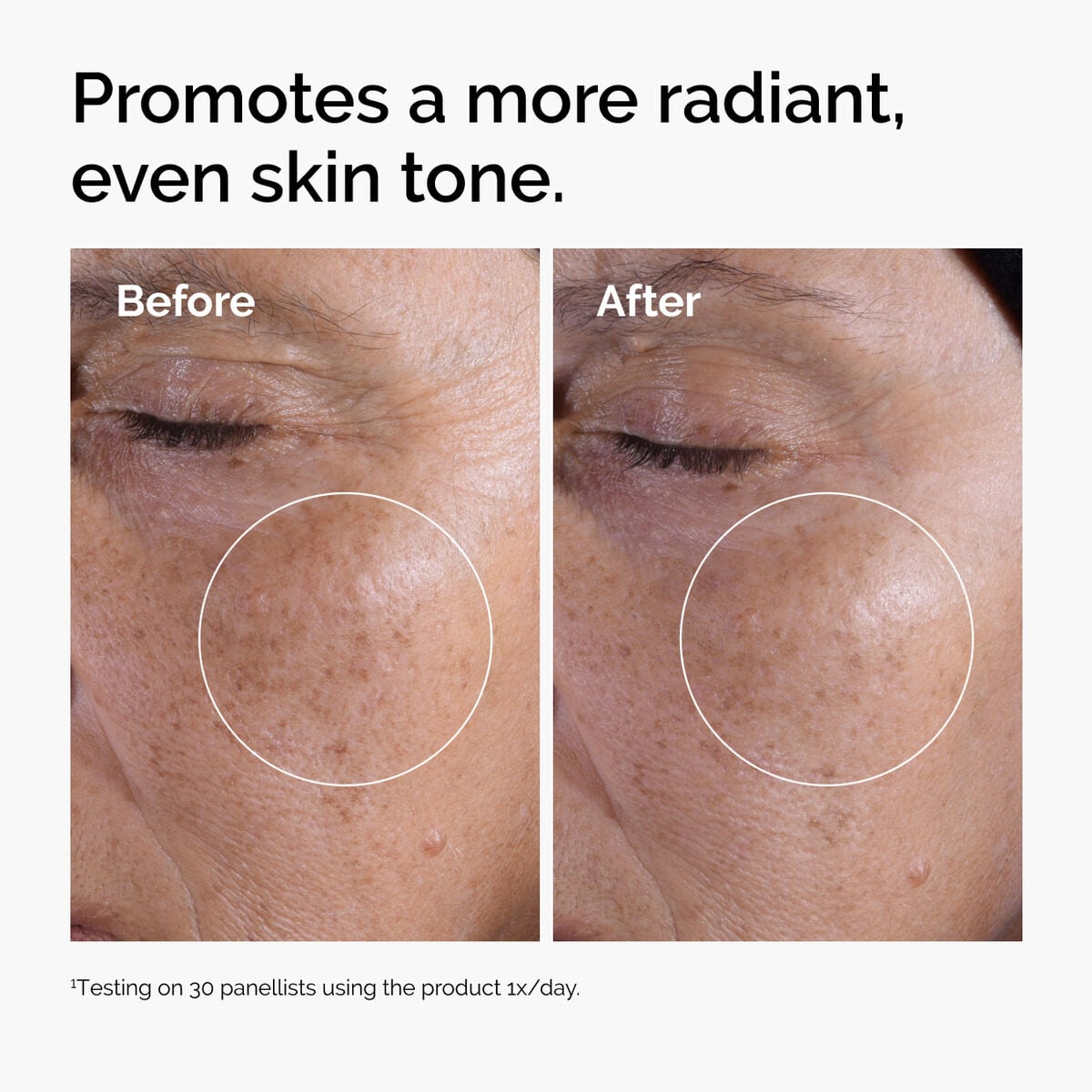 glycolic-acid-7-exfoliating-toner-f4 ord-glycolic-before-after-radiance.jpg