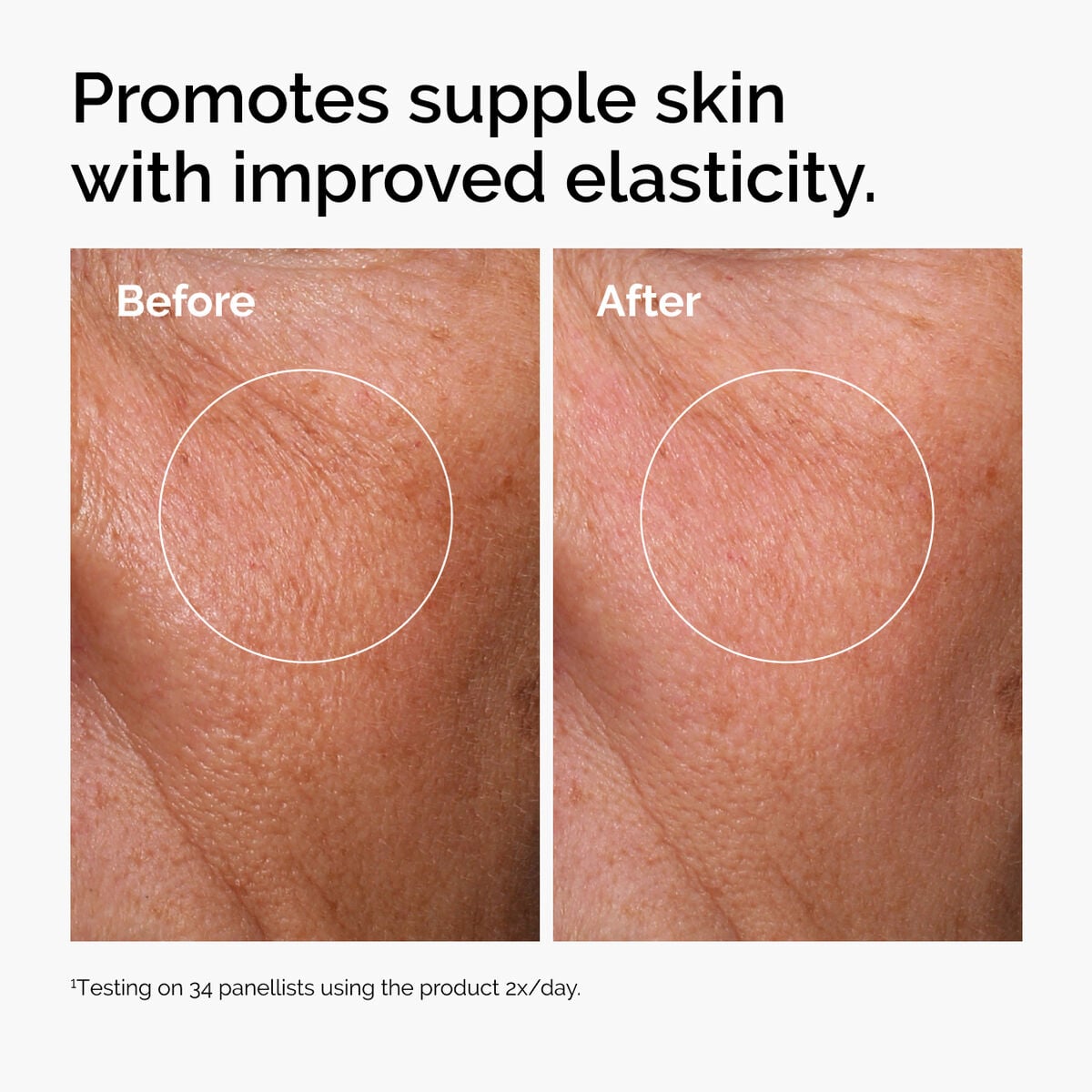 hyaluronic-acid-2-b5-with-ceramides-k4 ord-hyaluronic-acid-2pct-b5-hydrating-serum-before-after-elasticity.jpg