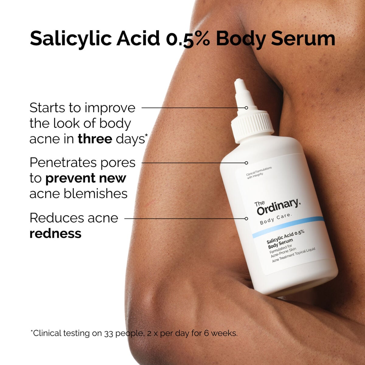 salicylic-acid-0-5-body-serum-m4 ord-salicylic-05-body-serum-otc-benefits-infographic.jpg