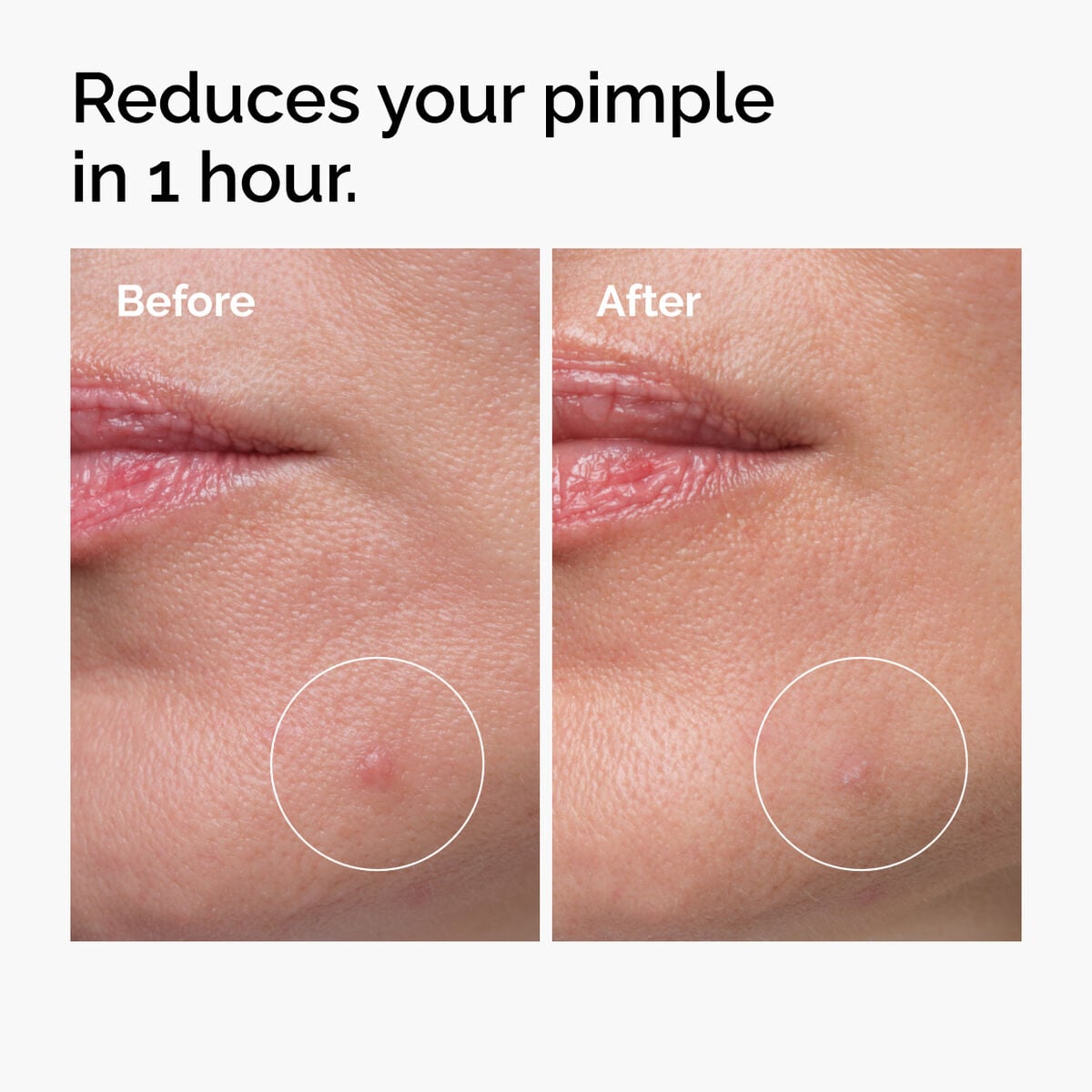 sulfur-10-powder-to-cream-concentrate-d9 ord-sulfur-10pct-powder-to-cream-concentrate-before-after-NA.jpg